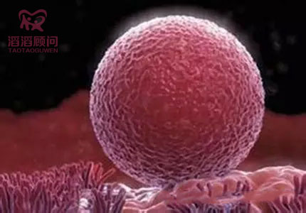 <b>36歲朱女士雙側(cè)輸卵管堵塞 赴俄羅斯試管好孕</b>