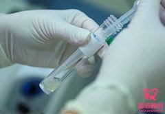 哪類人做試管嬰兒容易成功？