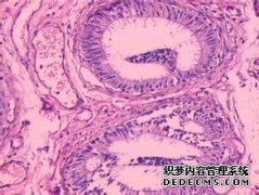 無(wú)精子癥能不能做試管嬰兒呢?
