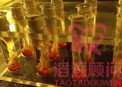 試管嬰兒取卵后雌激素高的癥狀