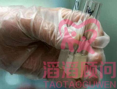 精子活力低做試管嬰兒有影響嗎?