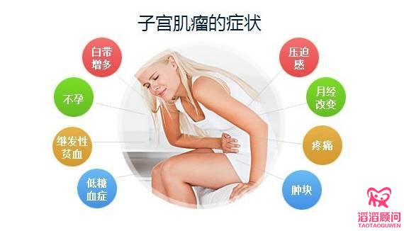 子宮肌瘤的癥狀