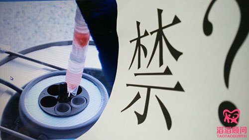 冷凍卵子