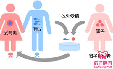 51歲的她仍在堅(jiān)持試管嬰兒