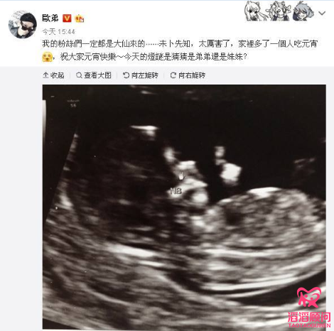 歐弟曝二胎是女兒