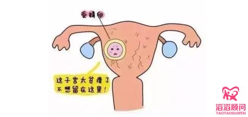 俄羅斯試管嬰兒