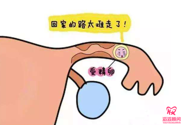 俄羅斯試管嬰兒