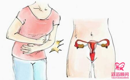 俄羅斯試管嬰兒