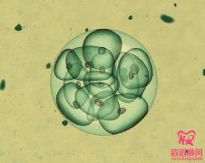 試管嬰兒取卵疼嗎？方法有哪幾種？