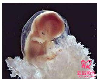 俄羅斯試管嬰兒