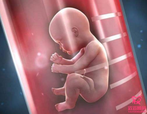 俄羅斯試管嬰兒
