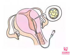 試管嬰兒要吃蛋白粉嗎？