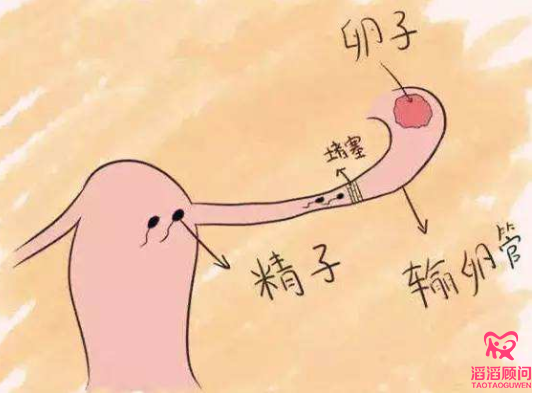 俄羅斯試管嬰兒