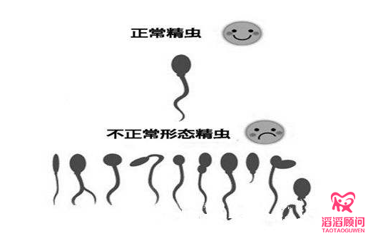 俄羅斯試管嬰兒