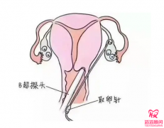 試管嬰兒對女性的傷害有哪些？