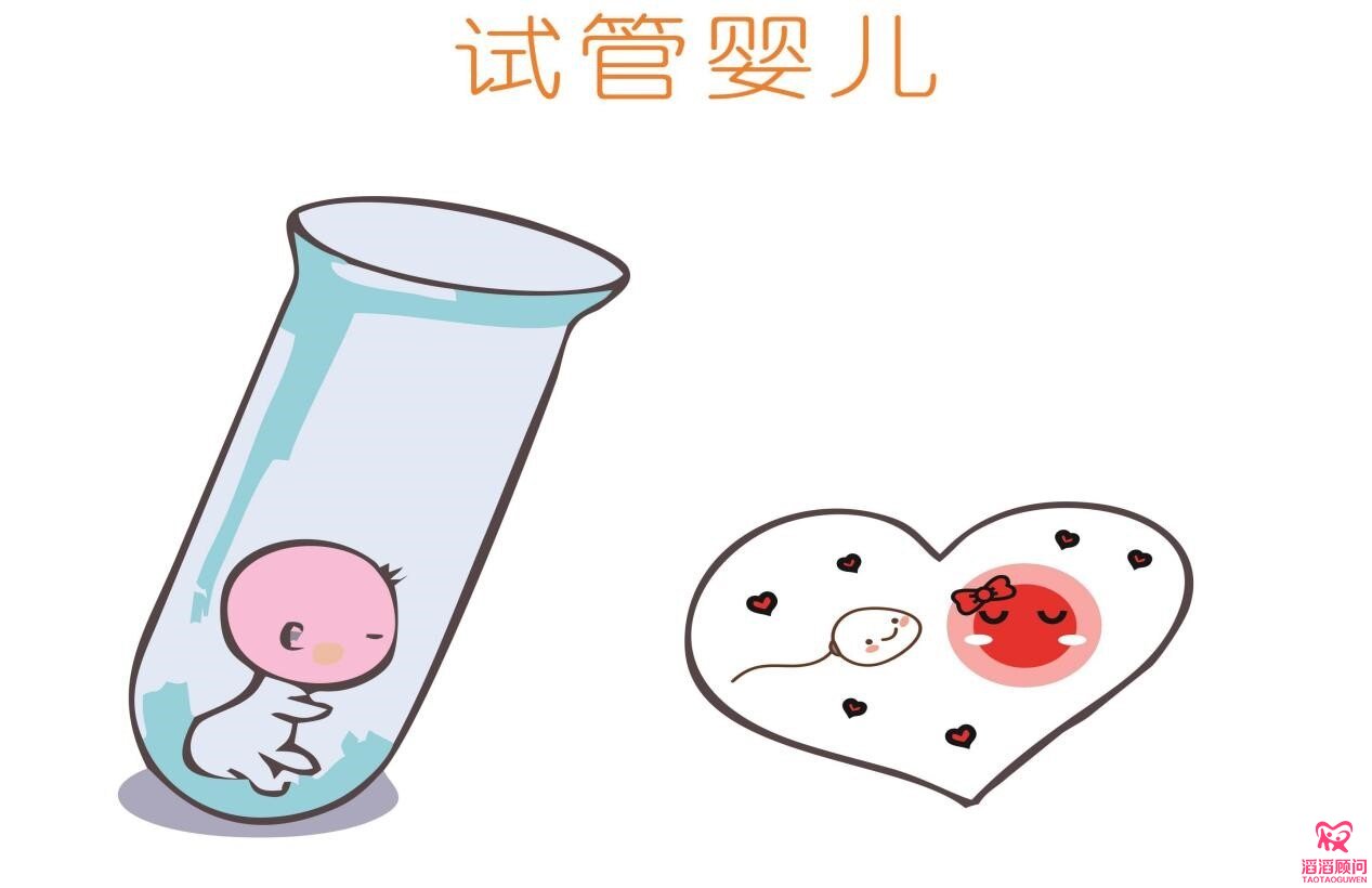 俄羅斯試管嬰兒