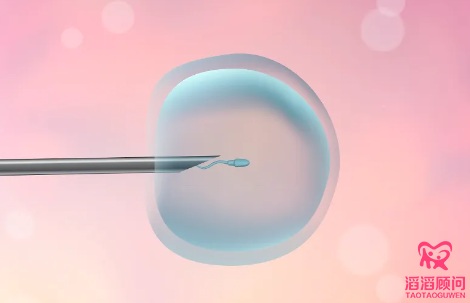俄羅斯第三代試管嬰兒