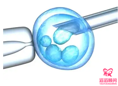 俄羅斯第三代試管